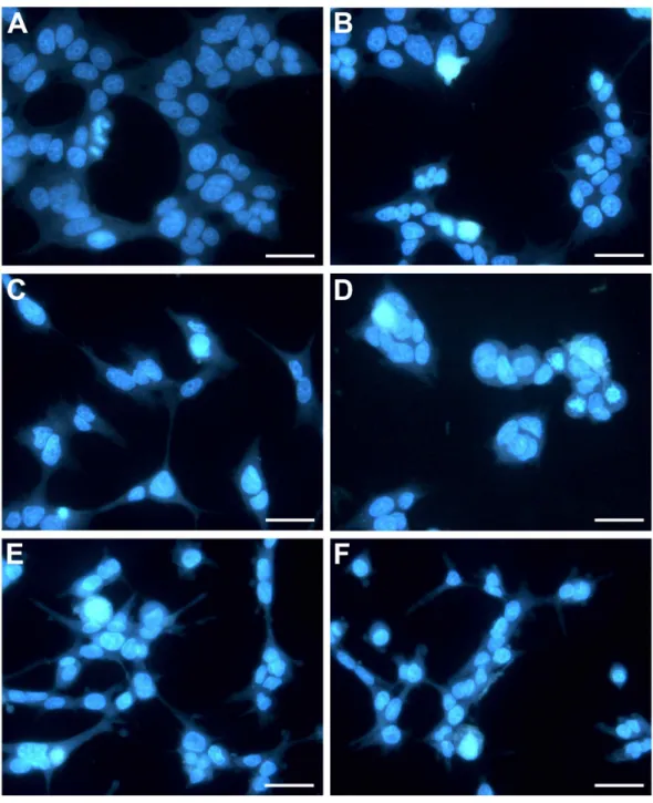 Figure 4 HepG2 cells exposed to CTH showing apoptotic features. Representative images