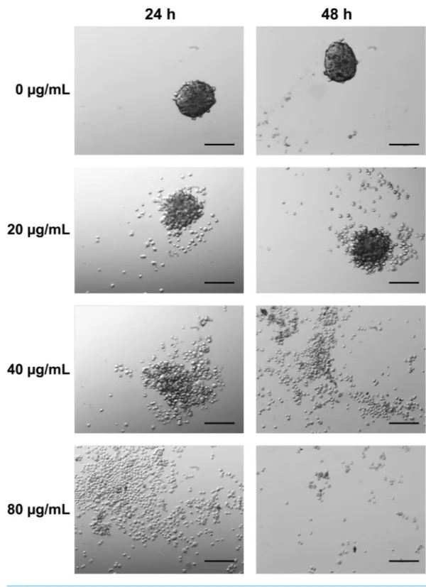 Figure 5 MCTS aggregation and morphology was influenced by CTH (20× magnification). Control MCTS, growing as a suspension of multicellular aggregates, are shown with no incubation