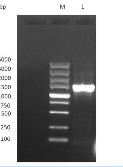 Figure 1 Electrophoresis analysis of GAD gene. Lane M, DL 2000 DNA Marker; lane 1, GAD gene of the strain.