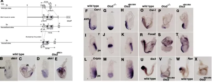 Figure 2. Dkk1 Expression Rescues Axis Rotation Defects Caused by Otx2 Mutation