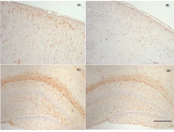 Figure 3 Representative photographs of the cerebral cortex and hippocampus samples showing GFAP expression