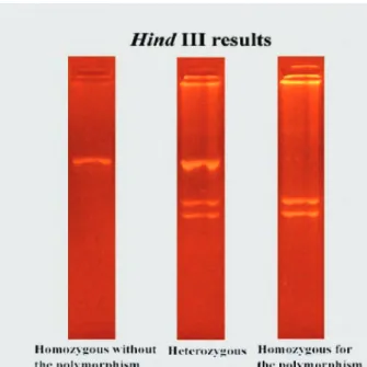 Figure 1. Electrophoresed pattern of LPL-HindIII polymorphism