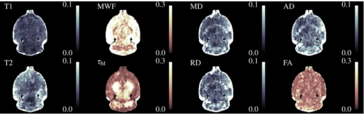 Figure 9 A coronal slice through the Co-efficient of Variation maps for selected parameters