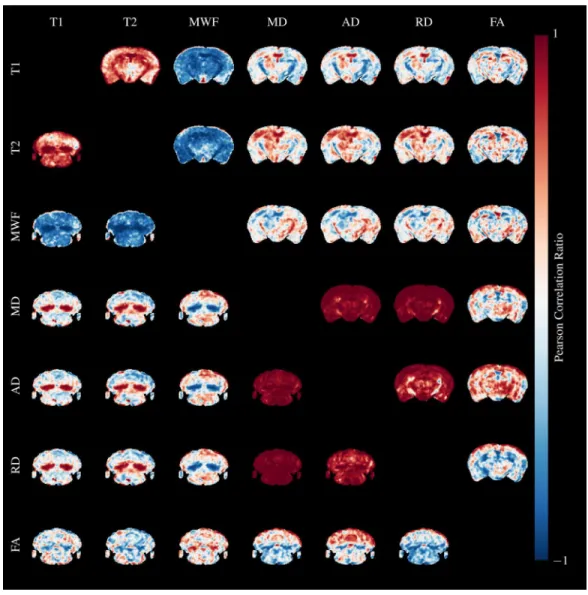 Figure 10 Pearson’s Correlation Ratio between each pair of MR parameters. A slice through the external capsule is shown above the diagonal and a slice through the cerebellum below the diagonal.