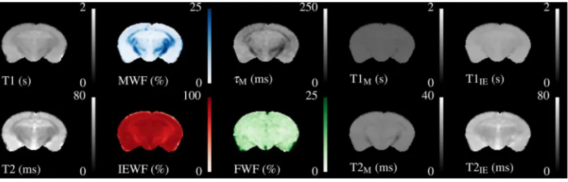 Figure 2 Illustrative relaxometry maps for a control mouse. Single-component T1&amp;T2 maps are in the left-most column