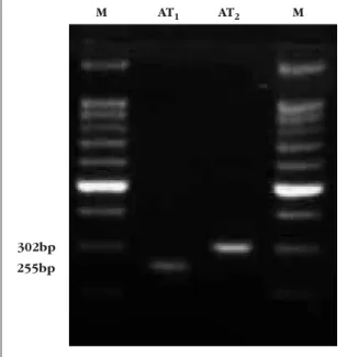 Figure 6  Gel electrophoresis of RT-PCR products demonstrating the presence of mRNA for angiotensin AT 1  -and AT 2 -receptors in human omental arteries