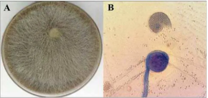 Figure 1. Rhizopus oryzae: A) culture on Sabouraud dextrose agar; B)  microscopy (lactophenol cotton blue, 40× magnification)