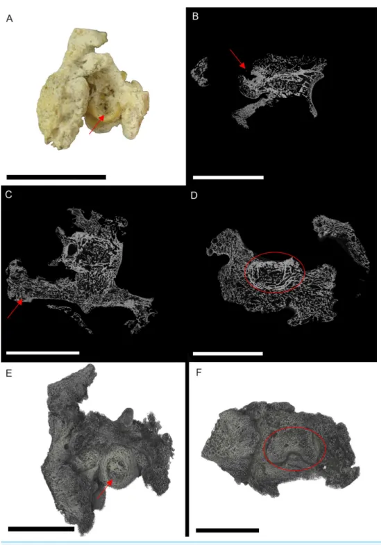 Figure 1 S. serpentarius (NHM S/1869.2.16.1) pedal phalanx; photograph of the specimen in plantar view (A), XMT slices in medial-lateral (B), dorsal-ventral (C) and transverse (D) views, and 3D  render-ing of the plantar (E) and distal (F) surfaces