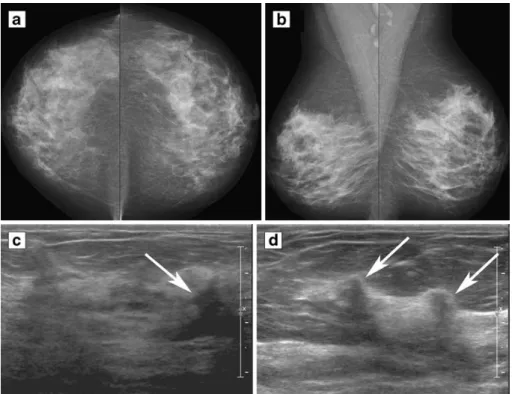 Figure 2.3: Selected images of a 54-year-old asymptomatic woman with dense breasts and no previous history of breast cancer