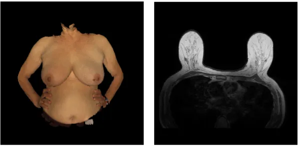 Figure 4.2: Scan and MRI data from the BCCT.plan project.