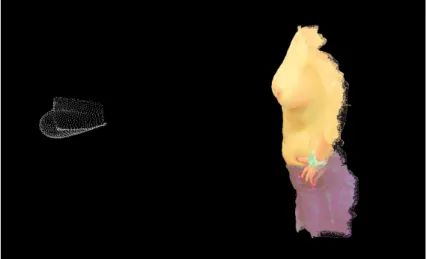 Figure 4.6: On the left: original MRI PCL. On the right: surface PCL.