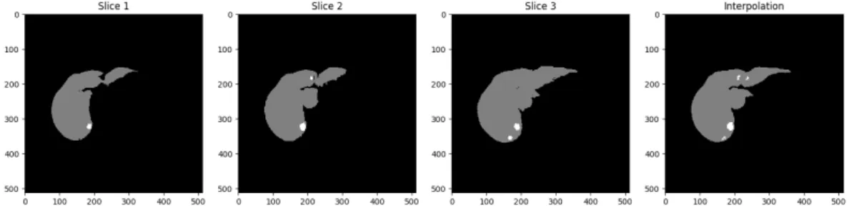 Figure 3.7: Left: Three raw segmentation slices. Right: Interpolated result.