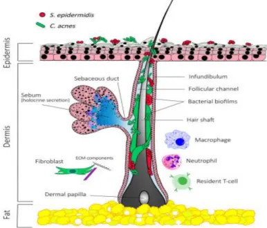 Figura  1-  Folículo  Pilossebáceo  com  microflora  comensal  constituída  tipicamente  por  bactérias  Propionibacterium  spp  e  Staphylococcus epidermidis