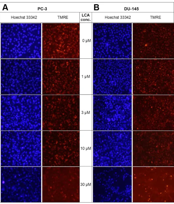Figure 13 Lithocholic acid induces mitochondrial dysfunction in PC-3 and DU-145 cells