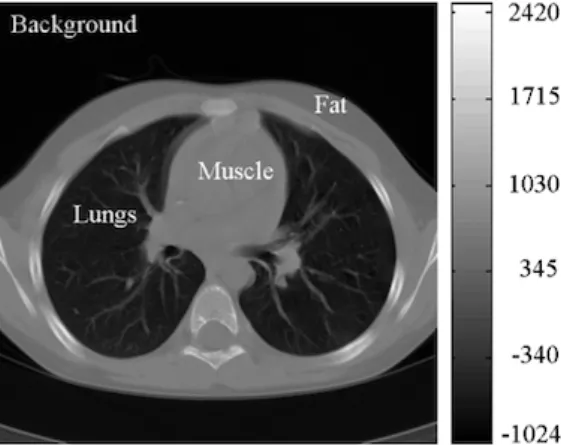 Figure 2.2: Original CT slice with lung tissues localization and intensity values are given in HU [7].