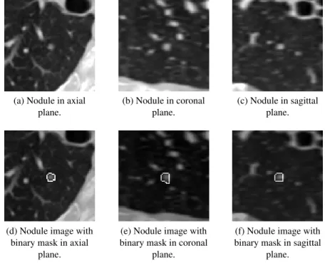 Figure 4.2: Nodule images from [4], without and with binary mask in axial, coronal, and sagittal planes.