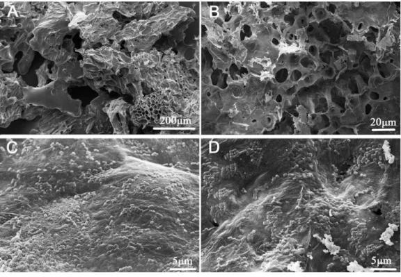 Figure 1 Scanning electron micrographs of okara and okara-immobilized L. plantarum 70810 cells.