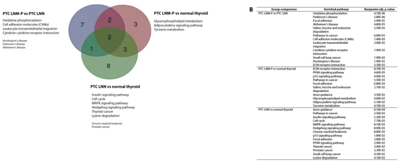 Figure 4 Significantly enriched pathways in PTCs. Significant KEGG pathway associations to 8611 significantly deregulated genes in PTC LNM-P versus PTC LNN, 14,192 genes in PTC LNM-P versus normal thyroid and 13,392 genes in PTC LNN versus normal thyroid.