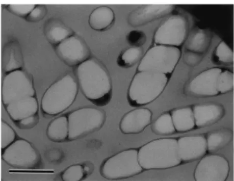 Figure 1.2: Transmission electron micrograph of thin sections of recombinant R. eutropha PHB -  4 cells containing large  amounts (90% of the dry cell weight) of P(3HB-co-5 mol% 3HHx)