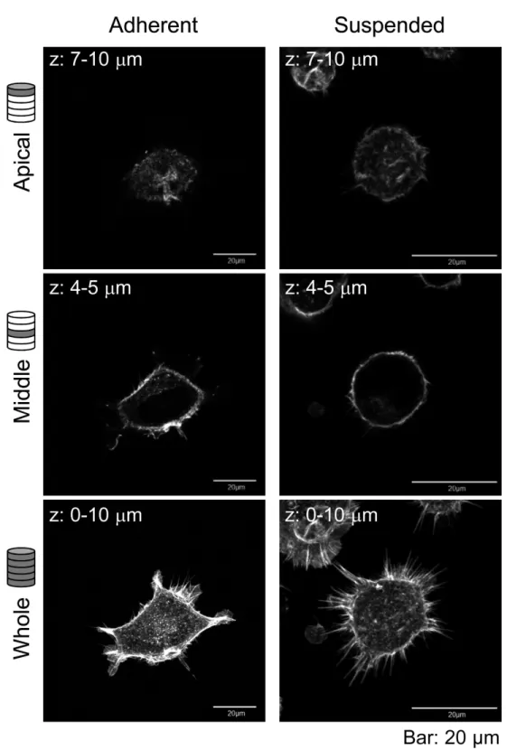 Figure 2 Confocal laser-scanning microscopy (CLSM) images of fluorescently labeled F-actin of adhered and BAM-anchored suspended HEK293 cells