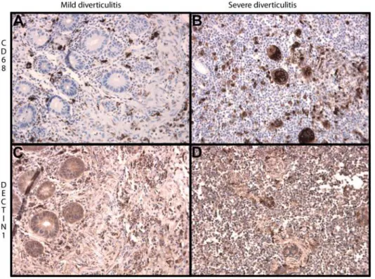 Figure 2. Representative immunohistochemical staining of dectin-1 and CD68 in mild and severe diverticulitis (250 6 magnified).