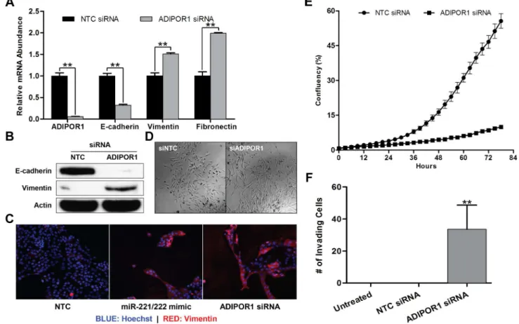 Figure 2. ADIPOR1 negatively regulates the EMT. (A) qRT-PCR analysis of MCF10A cells, 48 hours post transfection with either non-targeting control (NTC) or ADIPOR1 siRNA