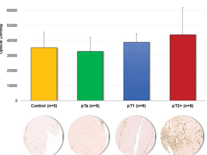 Fig 5. Immunohistochemical staining of Annexin A6. Quantification results obtained from non-cancerous tissue and bladder cancer tissues (pTa, pT1 and pT2+) along with the representative images of stained sections are presented