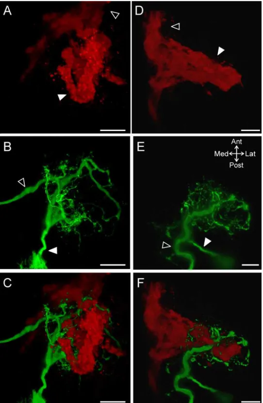 Fig 6. The ACO and MCN1 morphologies are similar within preparations despite variability across preparations