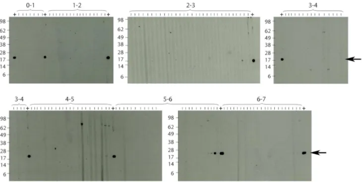 Figure 3. Western blot analysis of anti-18 kDa shsp IgG responses in children. Sera collected from children living in Mbandji 2 were tested for the presence of anti-M