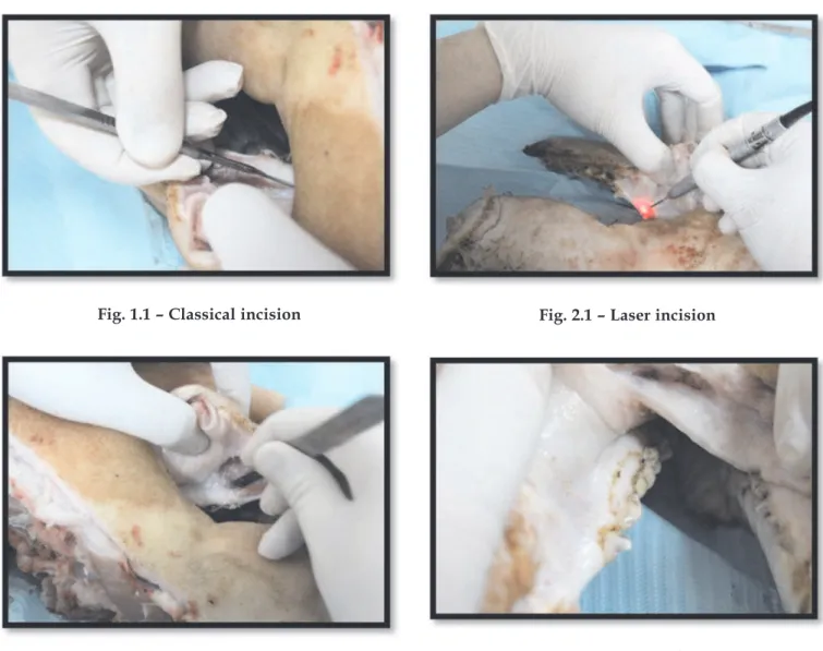 Fig. 1.2 – Tissue prelevation