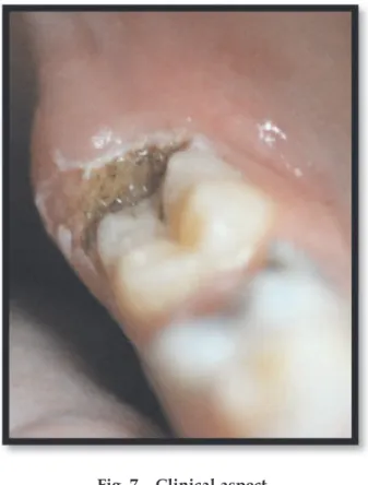 Fig. 7 – Clinical aspect 