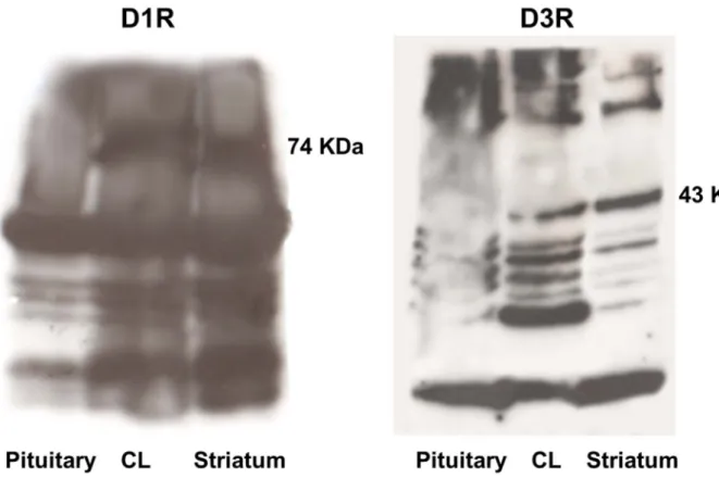 Figure 5. Immunoblot showing D1R and D3R in anterior pituitary (negative control), CL, and brain striatum (positive control) lysates.
