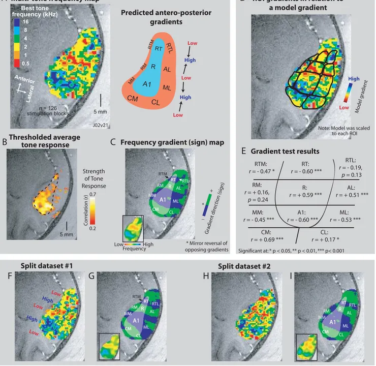 Figure 5. Delineating Borders and ROIs over Auditory Cortex