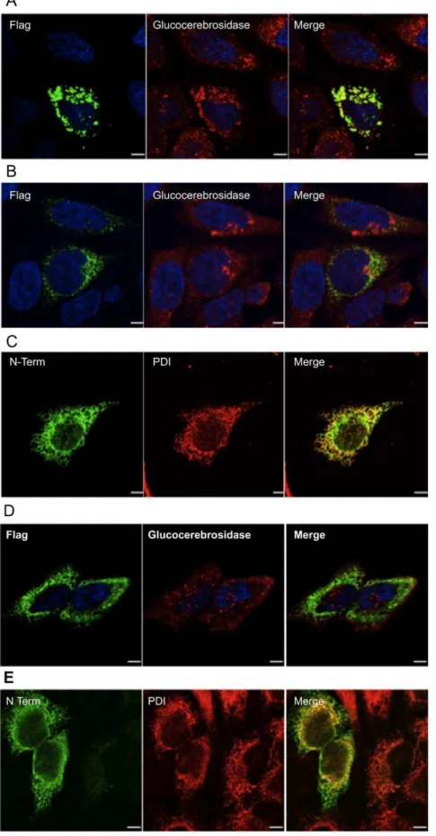 Figure 9. Indirect immunofluorescence staining and confocal microscopy imaging of HeLa cells transiently expressing various forms of N-acetyltransferase