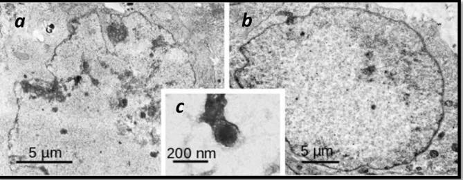Fig. 9 – a-b) Thin section TEM micrographs of HSV2 infected Vero cells processed for TEM at 14 hours p.i
