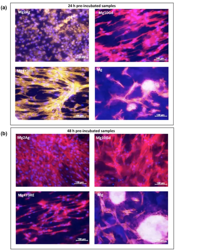 Fig 6. Confocal fluorescence microscopy of focal adhesion and actin cytoskeleton in HUCPV cells cultured for 24 h on Mg2Ag, Mg10Gd, Mg4Y3RE and Mg on 24 h (a) and 48 h (b) pre-incubated samples