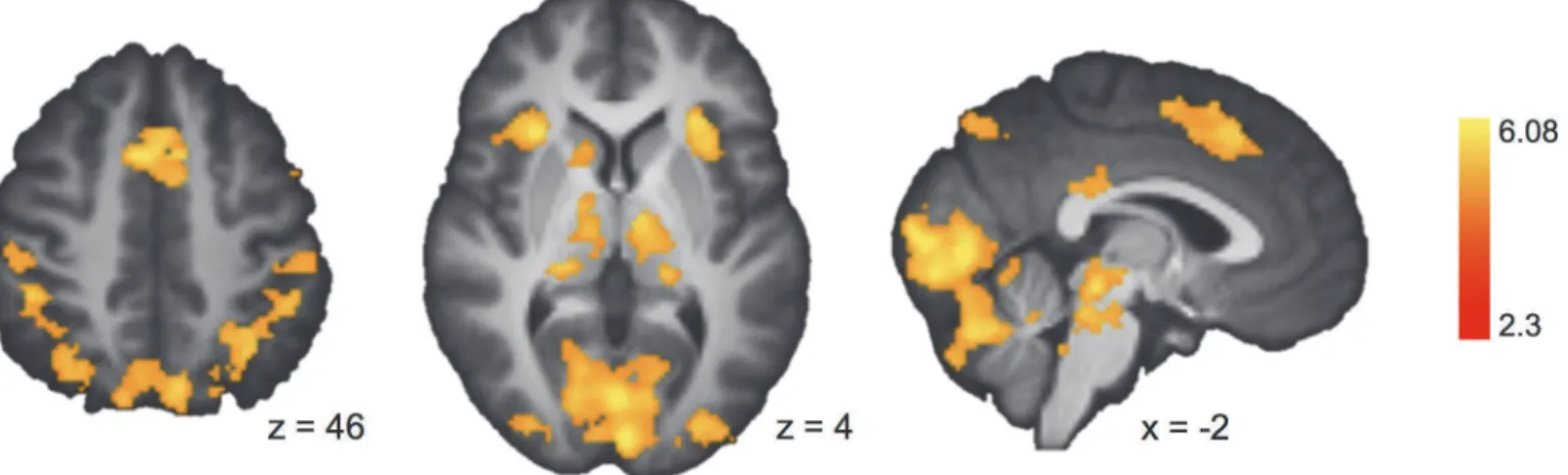 Table 2). In addition to visual and association cortices, we found activation in regions typically recruited during risky choice, including the anterior insula, the thalamus, and the paracingulate gyrus [10].