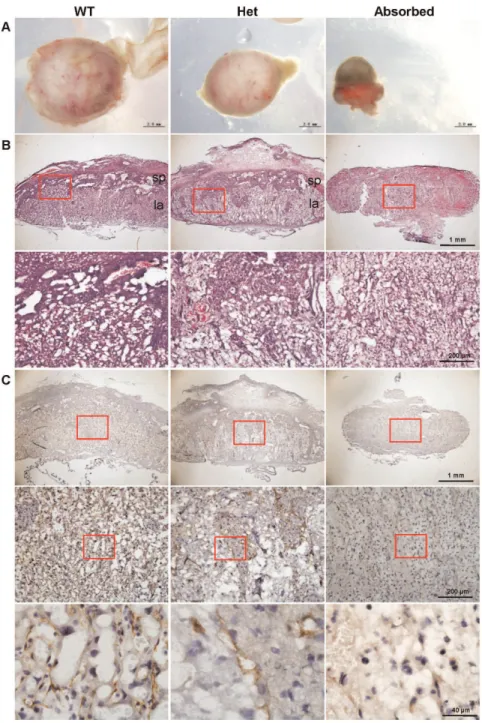 Figure 5. Morphology and histology of placentas of wild-type, Cul4b heterozygous and absorbed embryos at 14.5 dpc