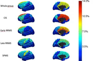 Fig 1. 3D Regional map of the frequency of the appearance of new grey matter lesions during the 5-year follow up in the whole group and in the different MS subsets.