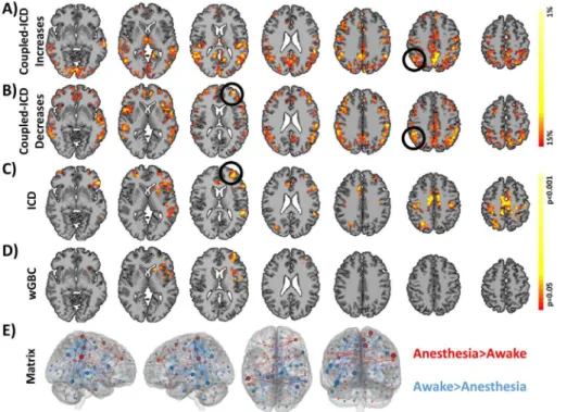 Figure 3. Comparison of coupled-ICD and conventional approaches for detecting connectivity changes due to anesthesia