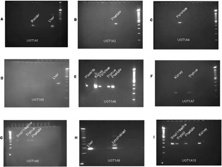 Figure 1. Expression of UGT1A isoforms among multiple human tissue samples. For each functional UGT1A isoform (A through I), an example for the PCR gels for expression in multiple human tissues together with molecular weight markers is shown.