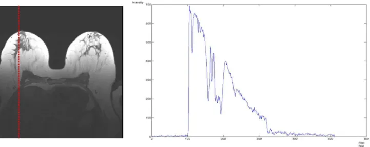 Figure 2. Intensity profile along the line, marked red in the example slice. The intensities of the same tissue (for example, the fatty part) in the upper slice part are about 700, and in the lower breast part they are close to 100.