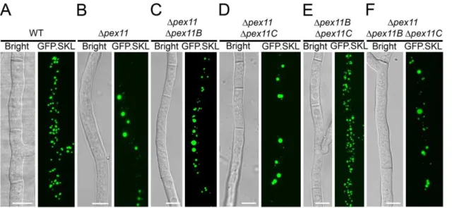Figure 5. P. chrysogenum cells devoid of all Pex11 family members still contain peroxisomes