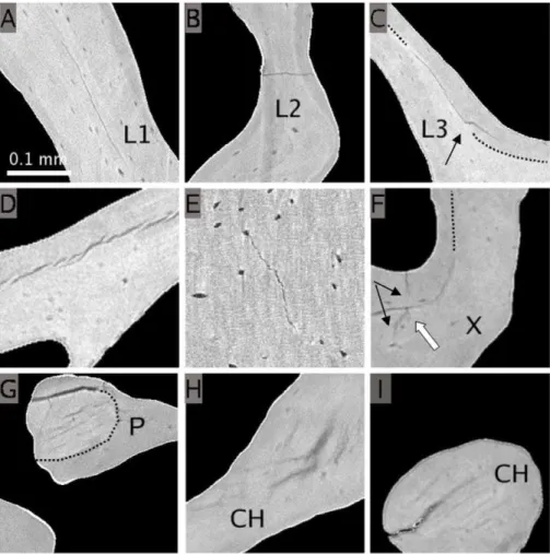 Figure 2. Illustration of various types of microcracks from 2D slices of SR micro-CT images