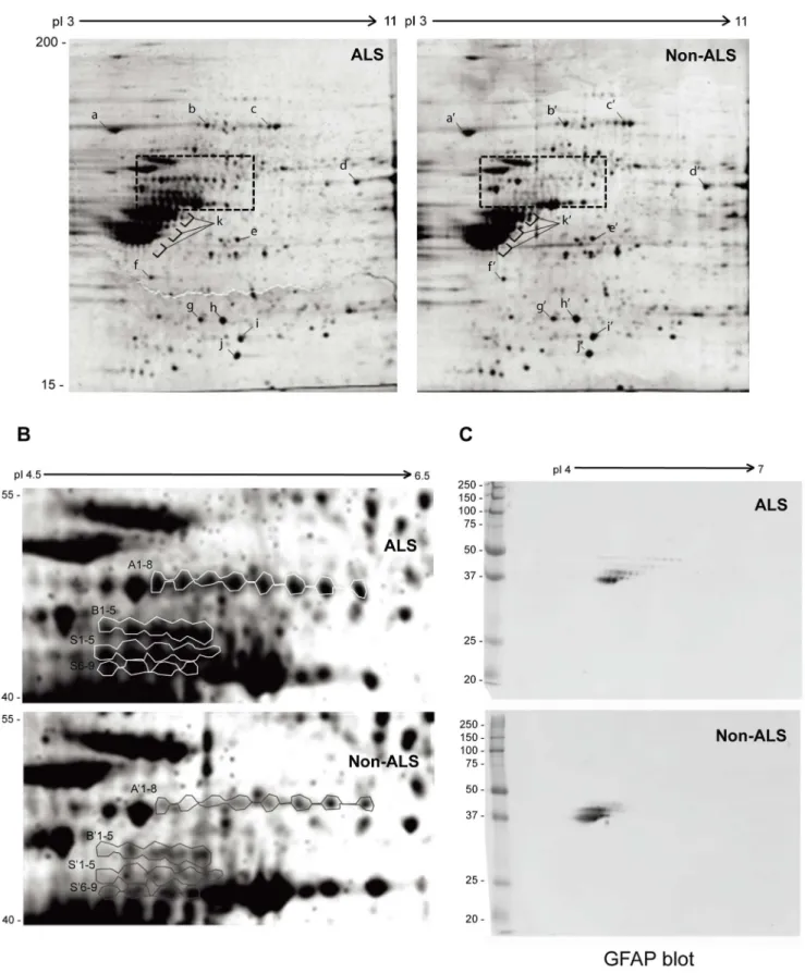 Figure 1. Comparison of urea-soluble proteins from ALS and non-ALS spinal cords by 2D SDS-PAGE
