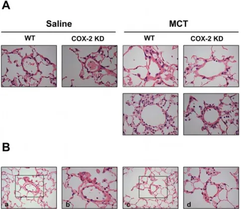 Figure 2. Minimal vascular pulmonary remodeling after MCT. A. Representative images 400x indicating only mild thickening of pulmonary arterioles from WT and COX-2 KD mice after MCT compared to saline