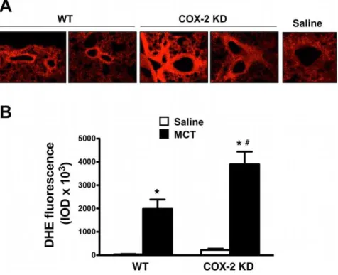 Figure 6. HO-1 mRNA is induced in response to MCT. HO-1 mRNA expression detected by quantitative RT-PCR in whole lung extracts