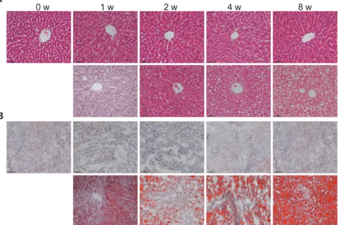 Fig 1. Development of hepatic steatosis upon HFHS dieting. Male Wistar rats (6 weeks old) were placed on chow diet or HFHS diet for 0, 1, 2, 4 and 8 weeks