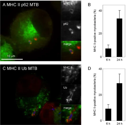 Figure 5.  Localization of MHC class II to mycobacterial autophagosomes in DC.  (A, C) Localization of MHC class II to p62- p62-positive or ubiquitin-p62-positive mycobacteria in JAWSII cells