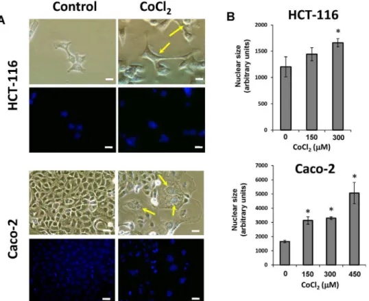 Figure 1. Morphological changes of colon cancer cells after treatment with CoCl 2 . A) Both HCT-116 and Caco-2 cell lines were treated with 300 mM CoCl 2 for 48 hours